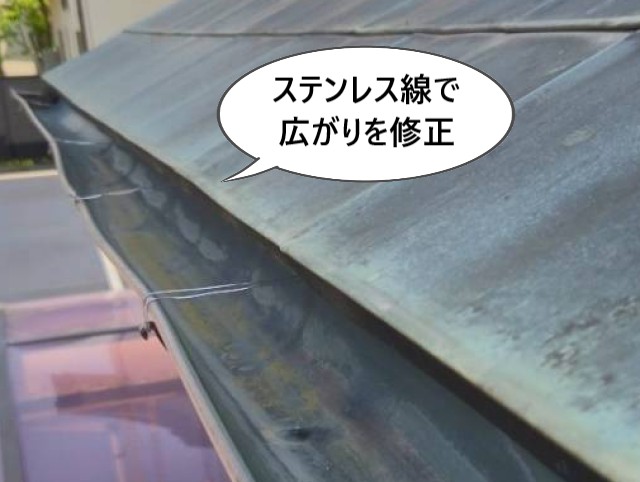 ステンレス線で広がりを修正